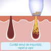 Aspirator facial, pentru un ten curat